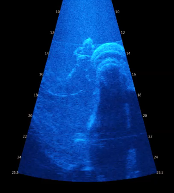 Sonar monitoring of divers